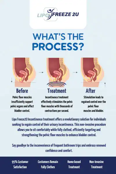 Diagram of how incontinence treatment Marylebone works.