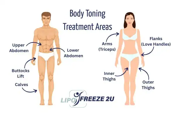 Graphic showing where you can have Body toning Treatment Marylebone on your body