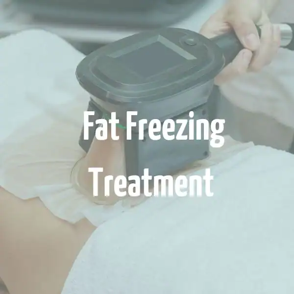 fat freezing treatment Marylebone